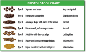 FMT - Fecal Microbiota Transplant Procedure - Bristol Stool Chart